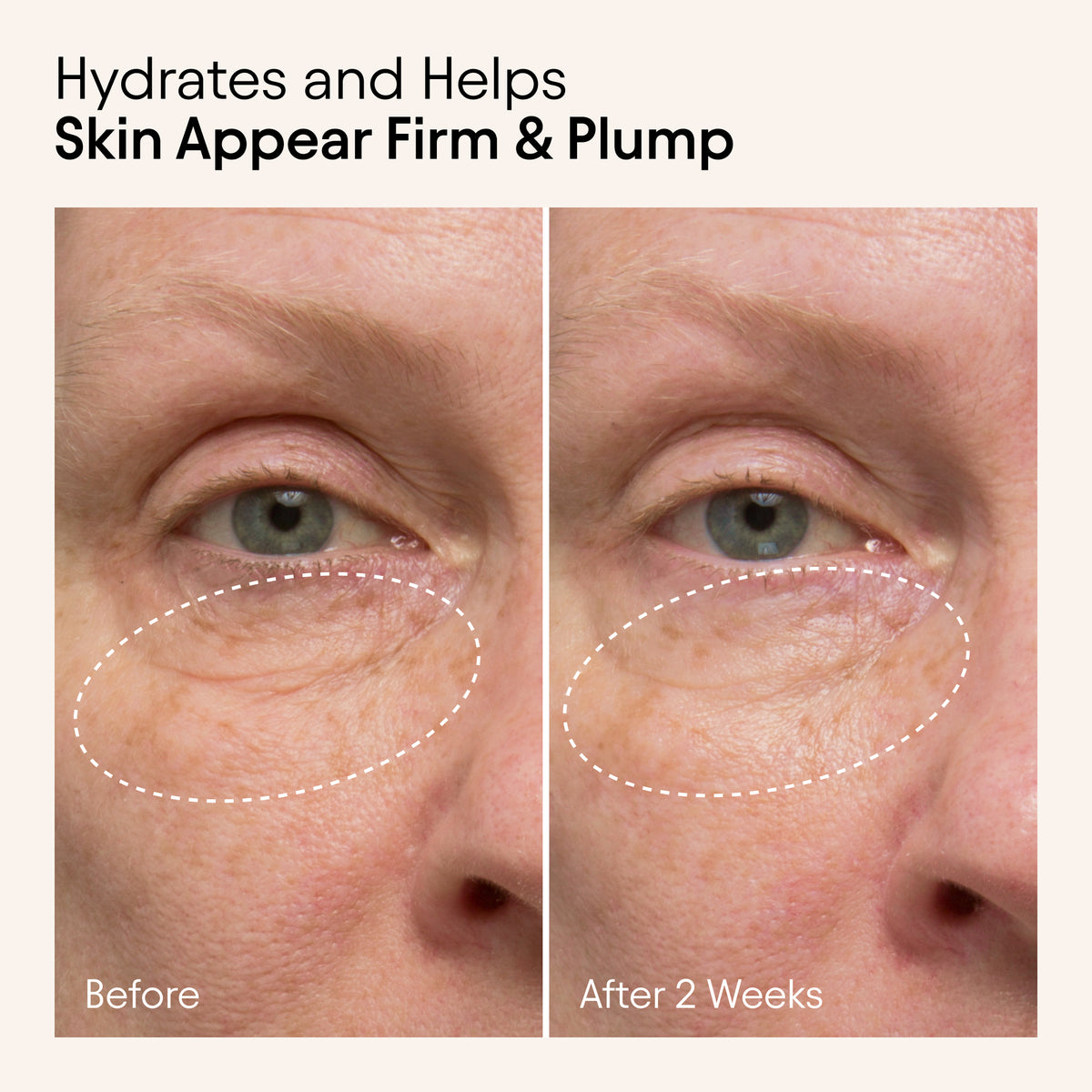 Alpyn Hydrating Firming Serum - AILLEA
