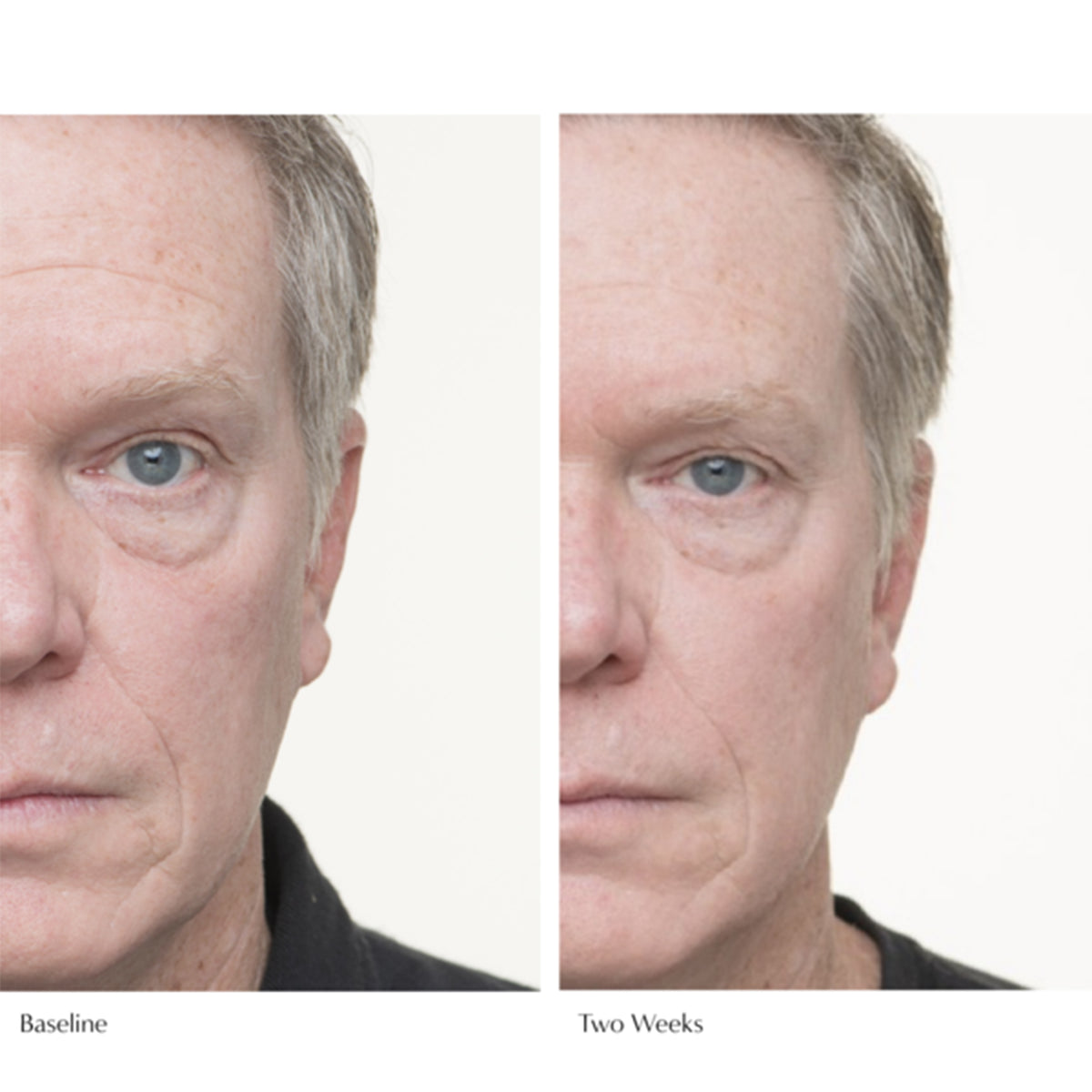 Le Prunier Plumscreen® - AILLEA