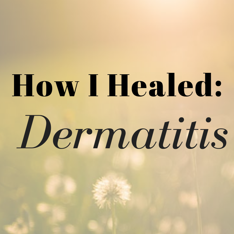 how I healed dermatitis 