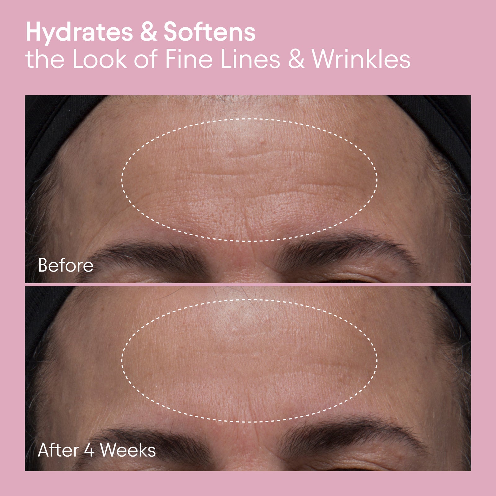 Alpyn PlantGenius Melt Moisturizer - AILLEA