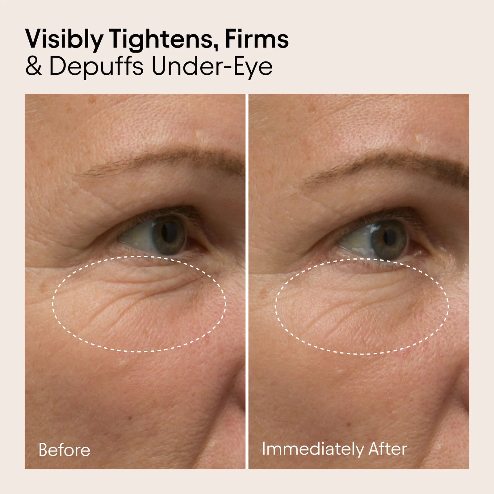 Alpyn Line-Filling Eye Balm - AILLEA