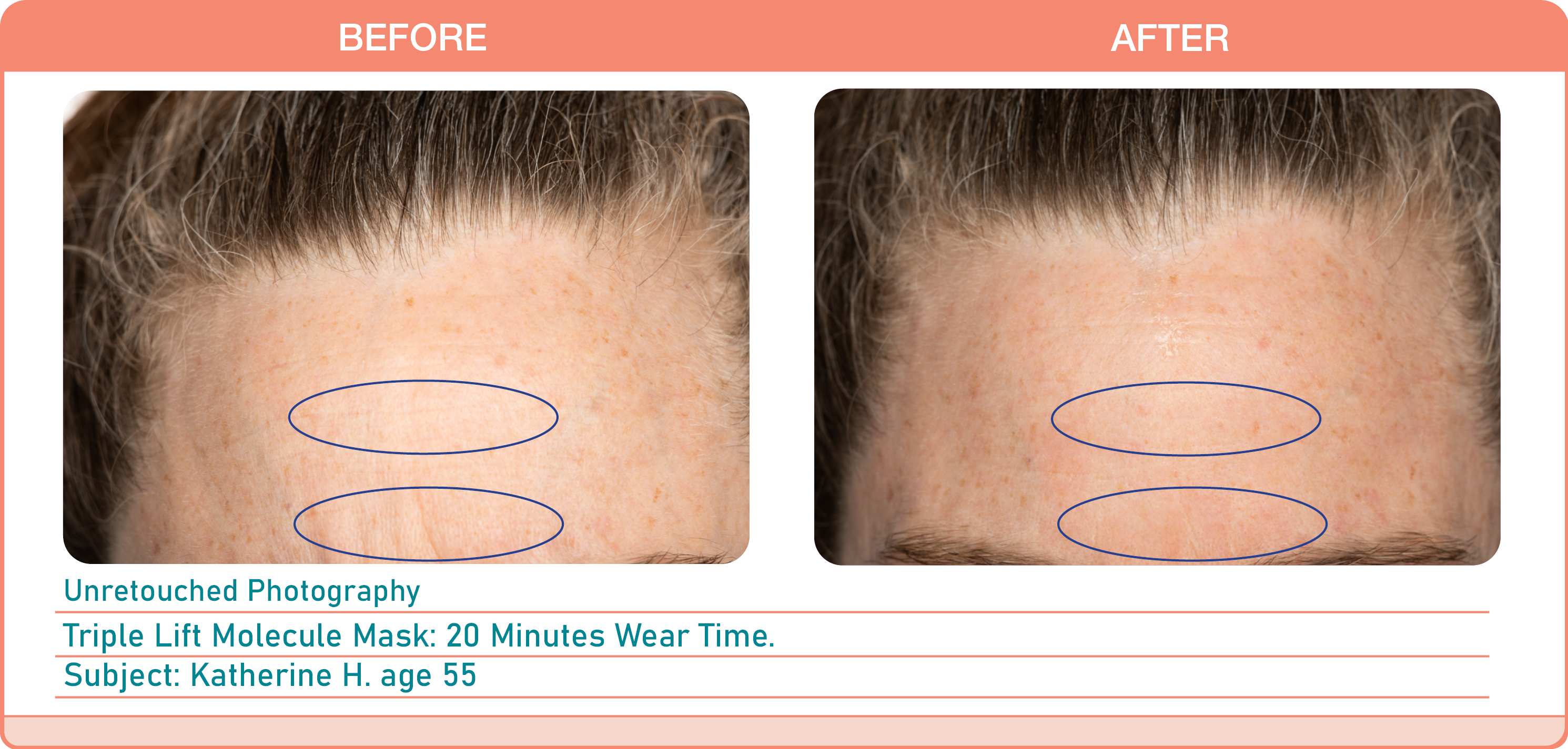 Caire Triple Lift Molecule Mask Before and After - AILLEA