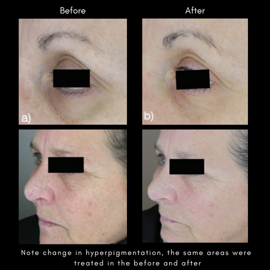 Maya Chia Advanced Response Complex (ARC) Treatment Face and Neck Cream - AILLEA