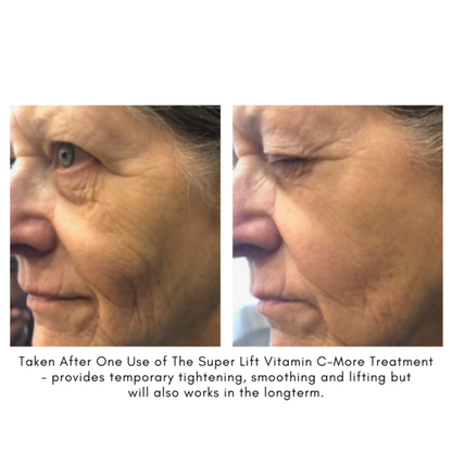 Maya Chia The Super Lift Vitamin C-More Treatment - before and after - AILLEA