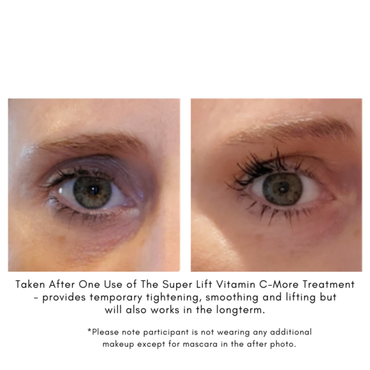 Maya Chia The Super Lift Vitamin C-More Treatment - before and after - AILLEA